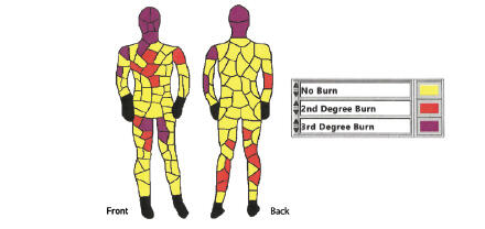 Figure B2. ASTM F1930 Output Showing No Burn (Yellow), Predicted Second-Degree Burn (Orange), and Predicted Third-Degree Burn (Purple)